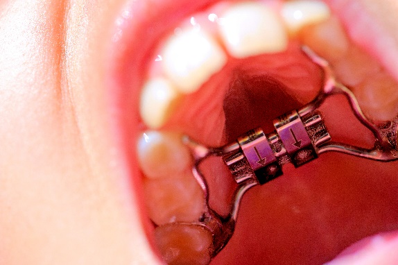 orthodontie-image-01